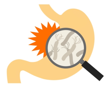 Дыхательный тест на определение Helicobacter Pilory в желудке