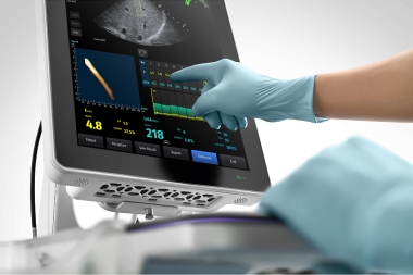 Эластометрия печени с использованием аппарата Hepatus 5