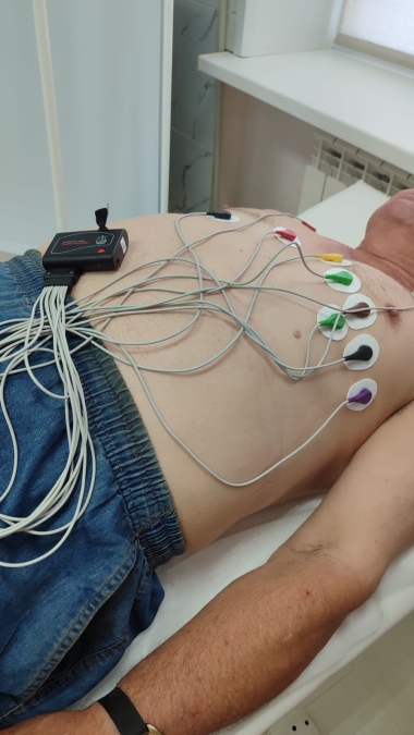 Холтеровское мониторирование ЭКГ (ХМЭКГ) и АД (СМАД)