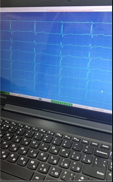 Холтеровское мониторирование ЭКГ (ХМЭКГ) и АД (СМАД)
